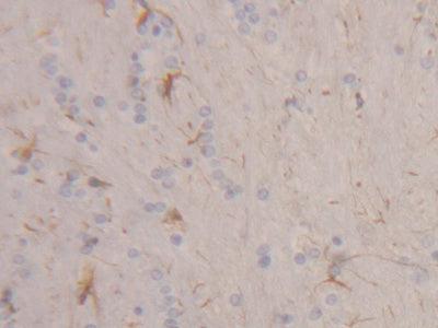Keratin 2 (CK2) Polyclonal Antibody - image 5