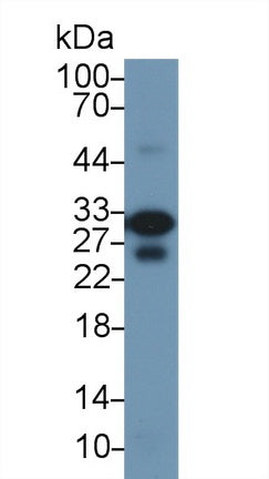Western Blot; Sample: Recombinant protein.