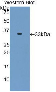 DAB staining on IHC-P; Samples: Rat Skin Tissue; Primary Ab: 10µg/ml Rabbit Anti-Rat TNNI3 Antibody Second Ab: 2µg/mL HRP-Linked Caprine Anti-Rabbit IgG Polyclonal Antibody