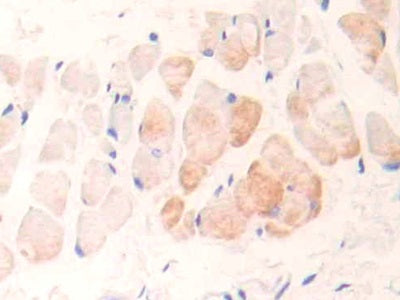 Cardiac Troponin I (cTnI) Polyclonal Antibody - image 4