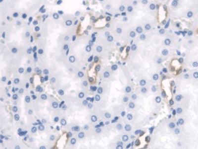 DAB staining on IHC-P; Samples: Rat Kidney Tissue)