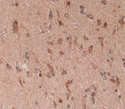Heat Shock Transcription Factor 2 (HSF2) Polyclonal Antibody - image 3