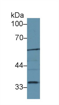 Western Blot; Sample: Recombinant protein.