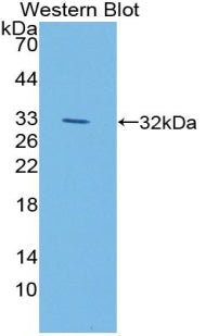 Used in DAB staining on fromalin fixed paraffin-embedded Liver tissue