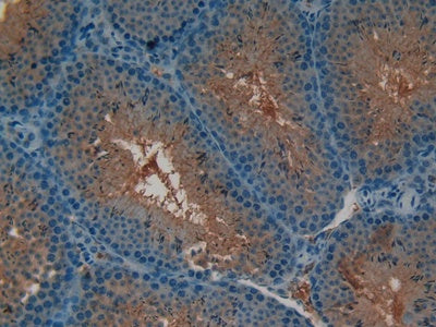DAB staining on IHC-P; Samples: Mouse Kidney Tissue.