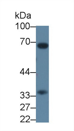 Western Blot; Sample: Lane1: Mouse Lung lysate; Lane2: 3T3-L1 cell lysate; Primary Ab: 0.3μg/ml Rabbit Anti-Rat CASP7 Antibody; Second Ab: 0.2µg/mL HRP-Linked Caprine Anti-Rabbit IgG Polyclonal Antibody;