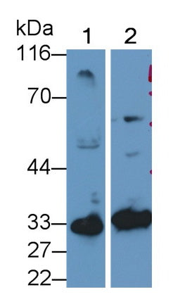 DAB staining on IHC-P; Samples: Rat Stomach Tissue;  Primary Ab: 20µg/ml Rabbit Anti-Rat CASP7 Antib