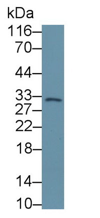 Western Blot; Sample: Lane1: Rat Liver lysate; Lane2: Porcine Small intestine lysate; Primary Ab: 0.1μg/ml Rabbit Anti-Human CASP7 Antibody; Second Ab: 0.2µg/mL HRP-Linked Caprine Anti-Rabbit IgG Polyclonal Antibody;