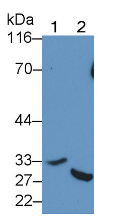 DAB staining on IHC-P; Samples: Human Stomach Tissue; Primary Ab: 20μg/ml Rabbit Anti-Human CASP7 Antibody Second Ab: 2µg/mL HRP-Linked Caprine Anti-Rabbit IgG Polyclonal Antibody
