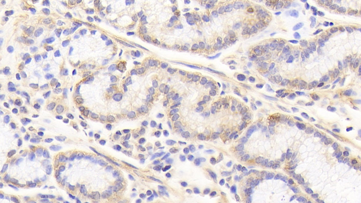 DAB staining on fromalin fixed paraffin-embedded Kidney tissue)