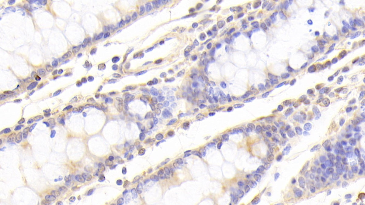 Caspase 7 (CASP7) Polyclonal Antibody - image 5