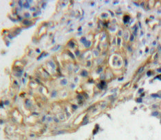 5T4 (5T4) Polyclonal Antibody - image 3