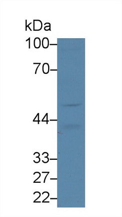 Western Blot; Sample: Recombinant protein.