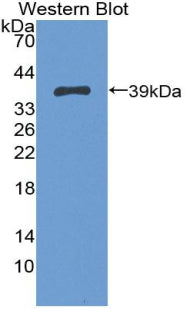 5T4 (5T4) Polyclonal Antibody - image 3