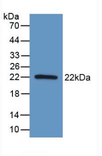 DAB staining on IHC-P; Samples: Human Liver Tissue; Primary Ab: 10µg/ml Rabbit Anti-Human AATK Antibody Second Ab: 2µg/mL HRP-Linked Caprine Anti-Rabbit IgG Polyclonal Antibody