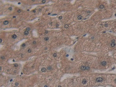 DAB staining on IHC-P; Samples: Human Prostate Gland Tissue.