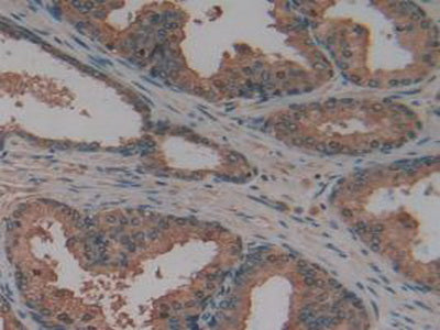 Apoptosis Associated Tyrosine Kinase (AATK) Polyclonal Antibody - image 5