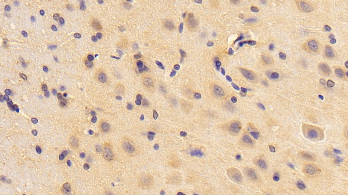 DAB staining on fromalin fixed paraffin-embedded brain tissue)