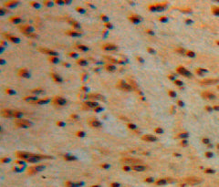 Protein Kinase C Gamma (PKCg) Polyclonal Antibody - image 4