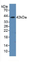 DAB staining on IHC-P; Samples: Rat Kidney Tissue; Primary Ab: 10µg/ml Rabbit Anti-Rat aHSP Antibody Second Ab: 2µg/mL HRP-Linked Caprine Anti-Rabbit IgG Polyclonal Antibody