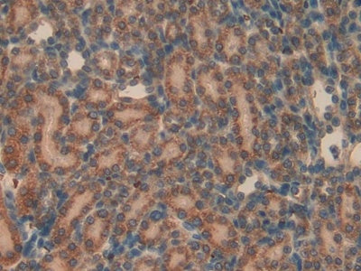 DAB staining on IHC-P; Samples: Rat Liver Tissue.