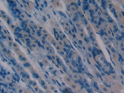 Alpha-Hemoglobin Stabilizing Protein (aHSP) Polyclonal Antibody - image 4