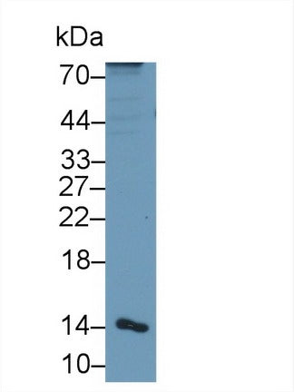 DAB staining on IHC-P; Samples: Human Spleen Tissue; Primary Ab: 20μg/ml Rabbit Anti-Human aHSP Antibody Second Ab: 2µg/mL HRP-Linked Caprine Anti-Rabbit IgG Polyclonal Antibody
