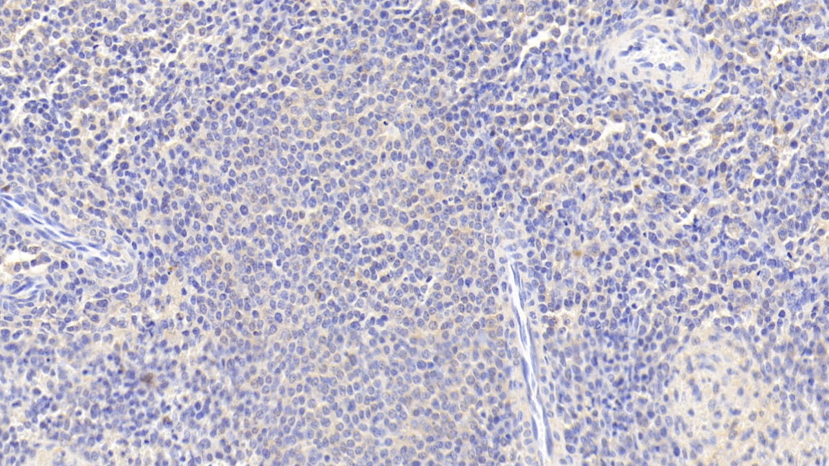 DAB staining on fromalin fixed paraffin-embedded Liver tissue)