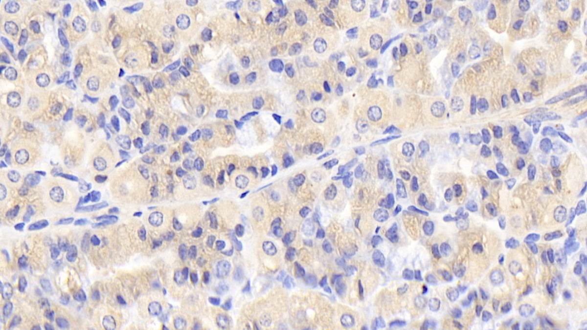 Alpha-Hemoglobin Stabilizing Protein (aHSP) Polyclonal Antibody - image 5