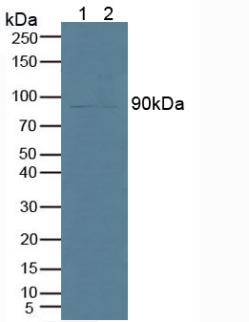 Western Blot; Sample: Recombinant iPLA2, Human.
