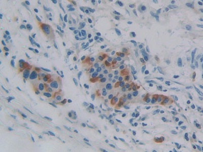 DAB staining on IHC-P; Samples: Human Pancreas Tissue