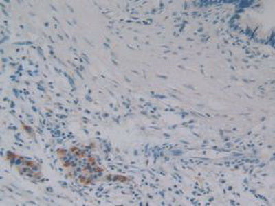 Phospholipase A2, Calcium Independent (iPLA2) Polyclonal Antibody - image 5