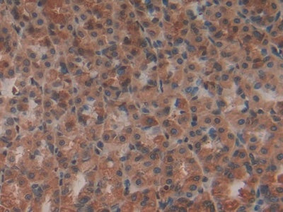 DAB staining on IHC-P; Samples:Rat Liver Tissue