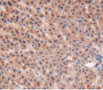 Matrix Metalloproteinase 12 (MMP12) Polyclonal Antibody - image 5