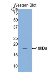 Retinol Binding Protein 1, Cellular (RBP1) Polyclonal Antibody - image 2