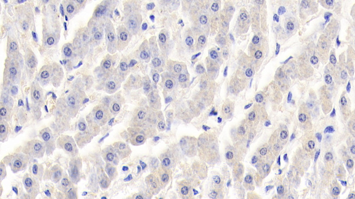Retinol Binding Protein 1, Cellular (RBP1) Polyclonal Antibody - image 3