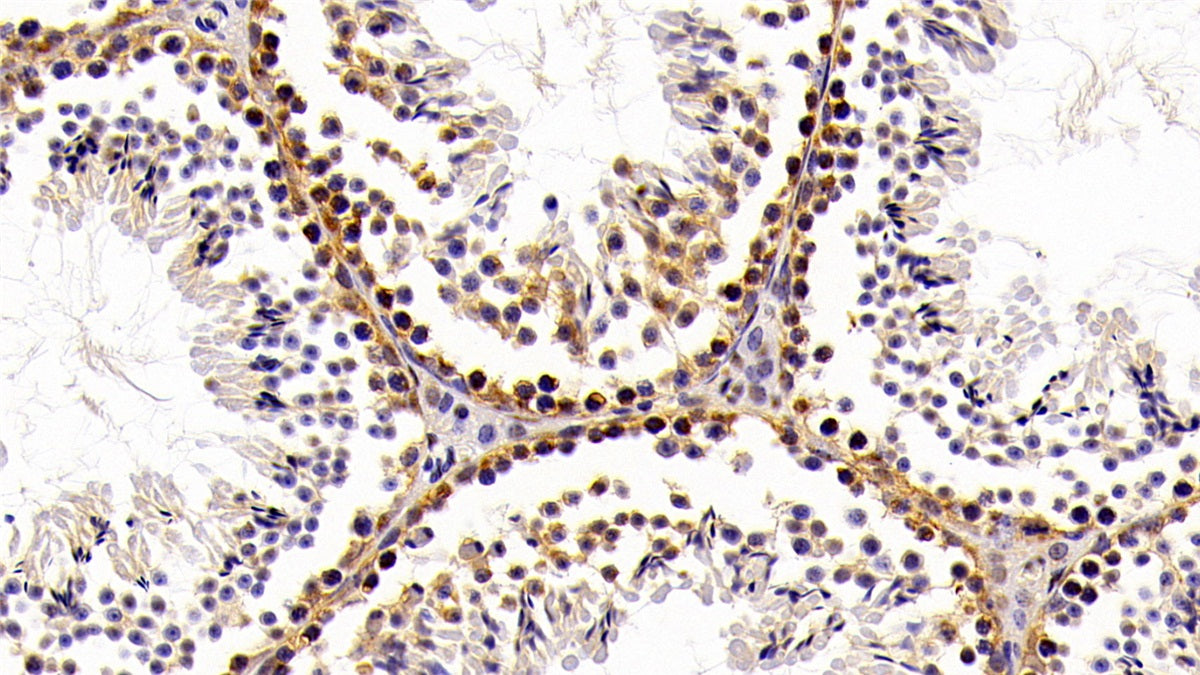 DAB staining on fromalin fixed paraffin-embedded Kidney tissue)
