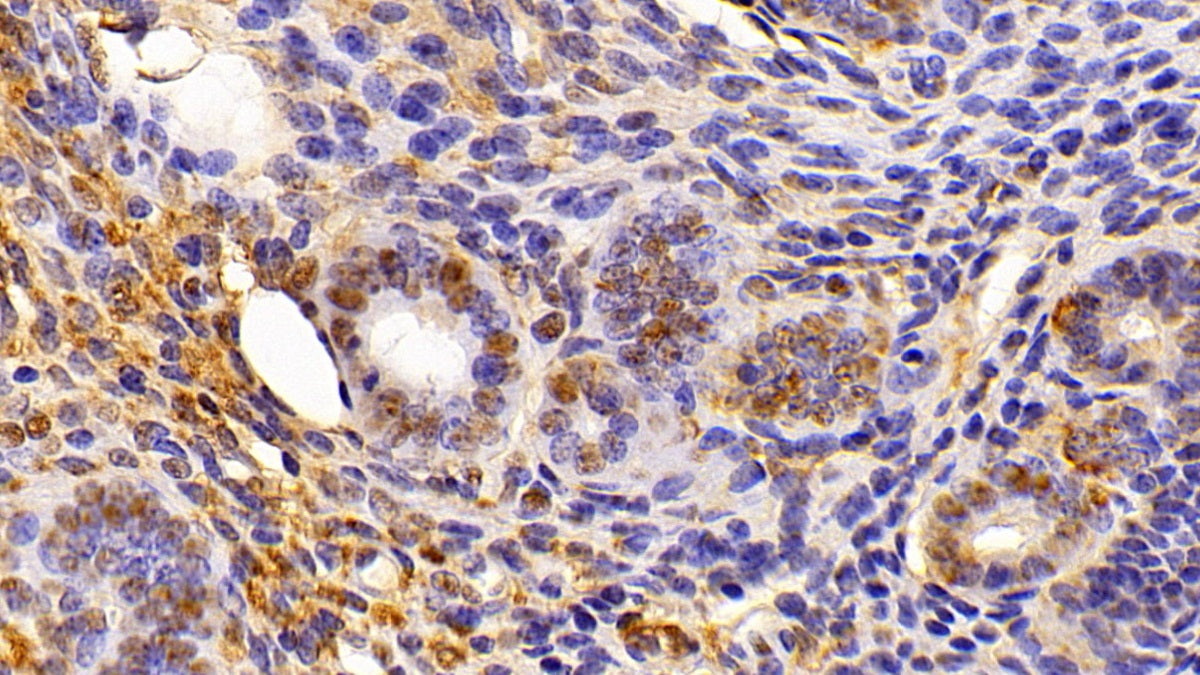 High Mobility Group Protein 1 (HMGB1) Polyclonal Antibody - image 5