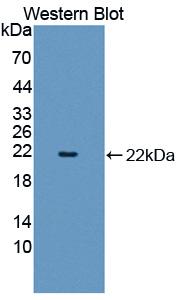 Sex Hormone Binding Globulin (SHBG) Polyclonal Antibody - image 2