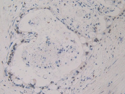 DAB staining on fromalin fixed paraffin- embedded stomach tissue)