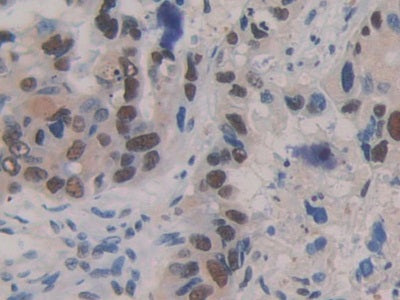 Sex Hormone Binding Globulin (SHBG) Polyclonal Antibody - image 4