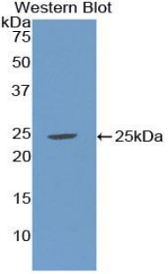 Western Blot; Sample: Human Placenta lysate; ; Primary Ab: 1µg/ml Rabbit Anti-Human SHBG Antibody; Second Ab: 0.2µg/mL HRP-Linked Caprine Anti-Rabbit IgG Polyclonal Antibody;