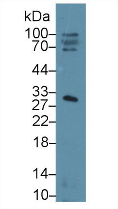 DAB staining on IHC-P; Samples: Human Liver Tissue; Primary Ab: 20μg/ml Rabbit Anti-Human SHBG Antibody Second Ab: 2µg/mL HRP-Linked Caprine Anti-Rabbit IgG Polyclonal Antibody