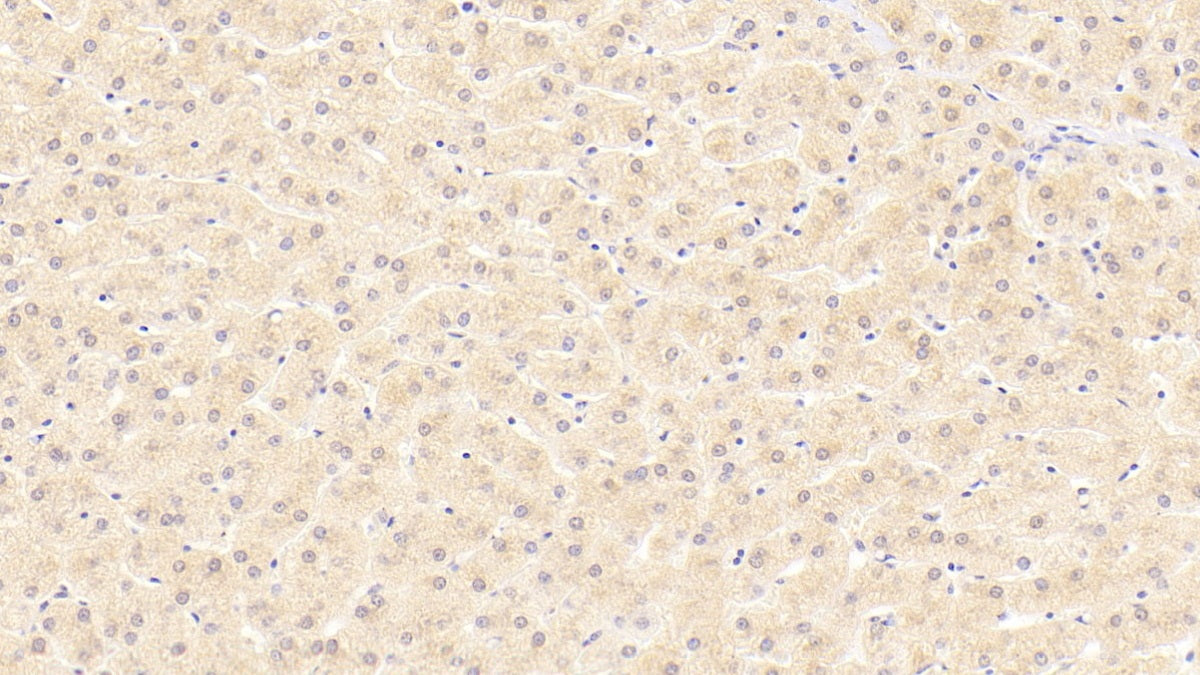 DAB staining on fromalin fixed paraffin-embedded Liver tissue)