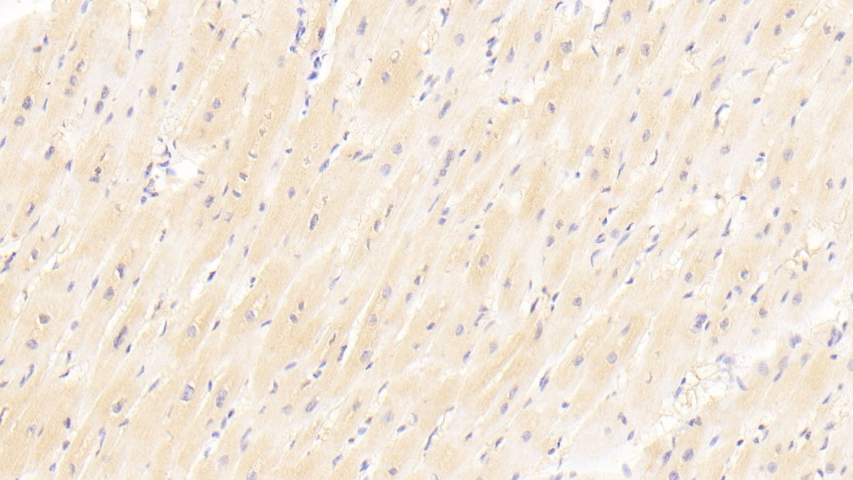 Sex Hormone Binding Globulin (SHBG) Polyclonal Antibody - image 5
