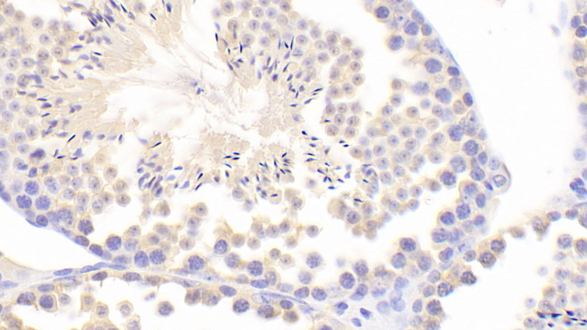 Inhibin Alpha (INHa) Polyclonal Antibody - image 4