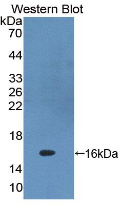 Protein Kinase Inhibitor Gamma (PKIg) Polyclonal Antibody - image 2