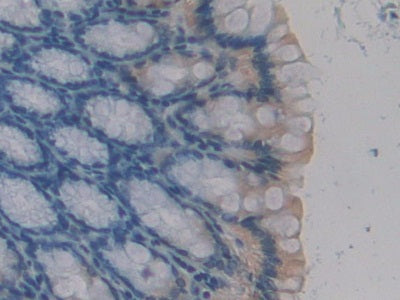 DAB staining on fromalin fixed paraffin- embedded ovary tissue)