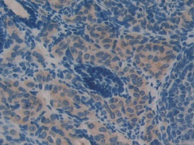 Protein Kinase Inhibitor Gamma (PKIg) Polyclonal Antibody - image 4