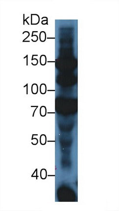 DAB staining on IHC-P; Samples: Mouse Liver Tissue; Primary Ab: 20μg/ml Rabbit Anti-Mouse C3a Antibody Second Ab: 2µg/mL HRP-Linked Caprine Anti-Rabbit IgG Polyclonal Antibody